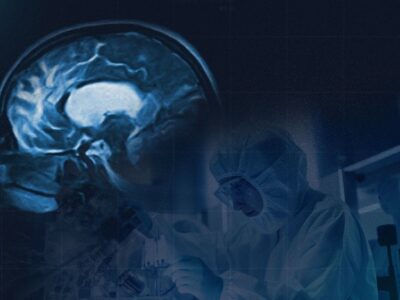 GEN y Sulfateq anuncian resultados positivos en fase 1 del fármaco SUL-238 para el Alzheimer