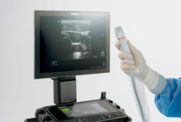 Sonosite LX introduce la ultra-alta frecuencia en POCUS con el primer y único transductor de 46 MHz