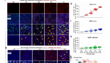 Un estudio publicado en Cell identifica ROCK2 como nueva diana terapéutica para la fibrosis hepática con el apoyo de Cloud-Clone