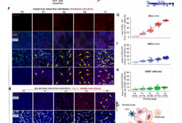 Un estudio publicado en Cell identifica ROCK2 como nueva diana terapéutica para la fibrosis hepática con el apoyo de Cloud-Clone